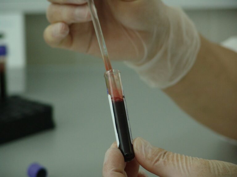 New, more contagious and virulent HIV variant discovered