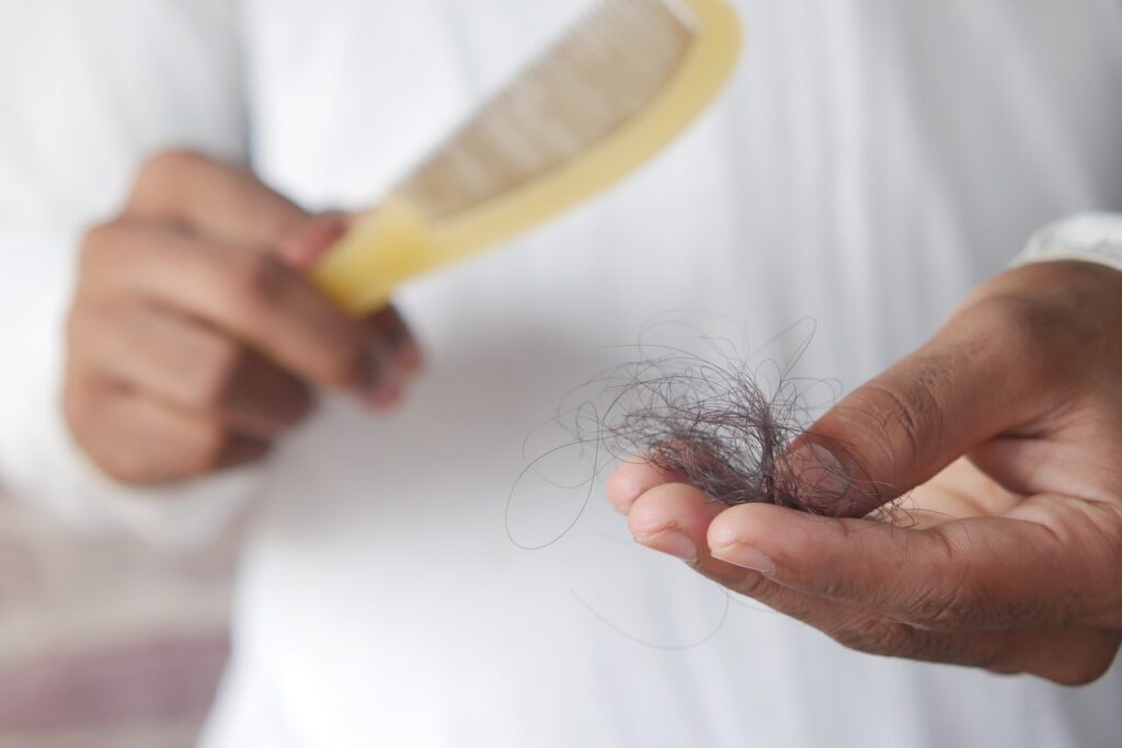 medicamento para la alopecia