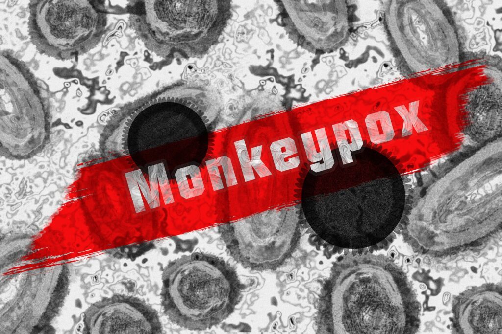 SF announces end of monkeypox emergency and maintains vaccination recommendation