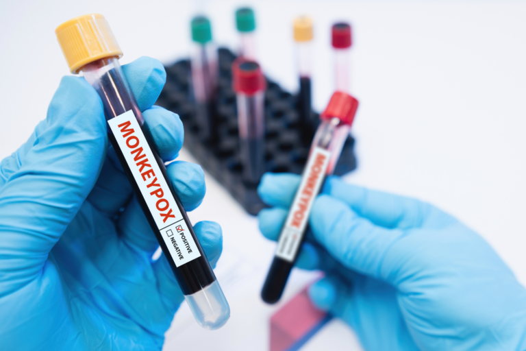 Stanford Virology Lab launches diagnostic test for monkeypox