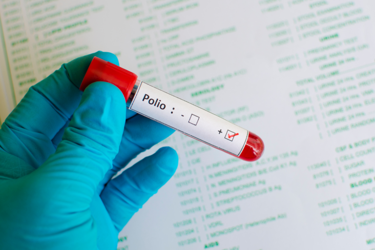 First U.S. polio case confirmed in nearly a decade