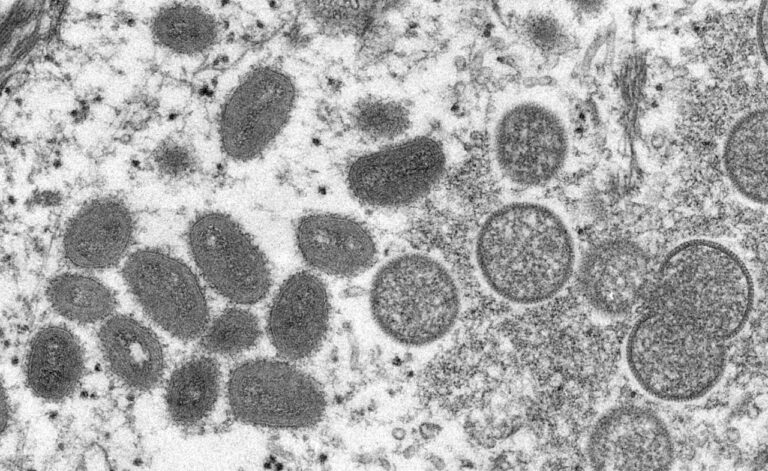 SF runs out of smallpox vaccine, more requested from federal government