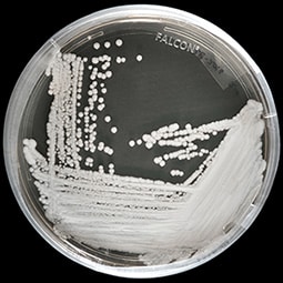 Cultivo de una cepa de Candida auris en una placa de Petri en los CDC.