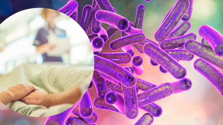 Condado de Santa Clara atiende la propagación de shigella en campamentos para personas sin hogar